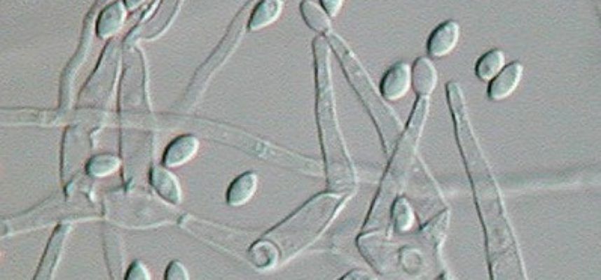 Paecilomyces_variotii_1640125278