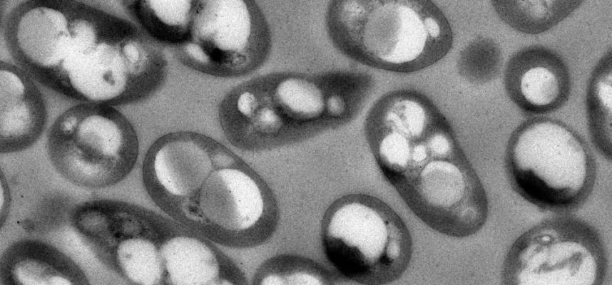 bacterias-mutantes-produciendo-plastico.-CIB