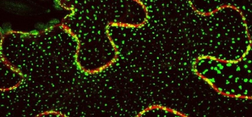 Imagen-de-microscopia-confocal-con-la-localizacion-de-la-proteina-Sinaptotagmina-1-unida-a-la-proteina-fluorescente-GFP.