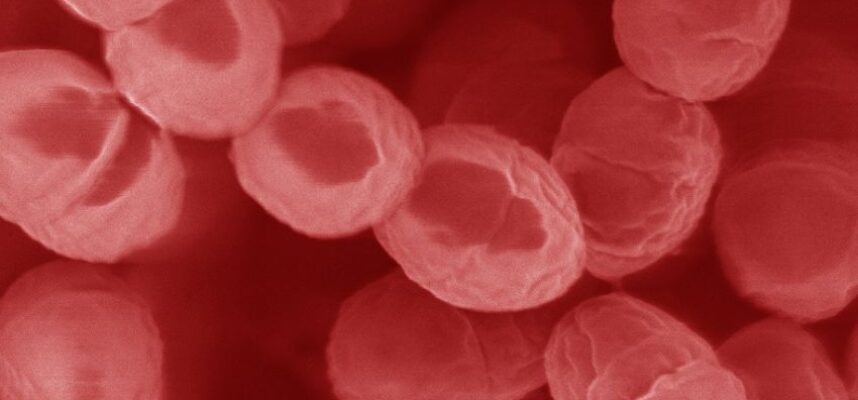 Lactococcus_lactis